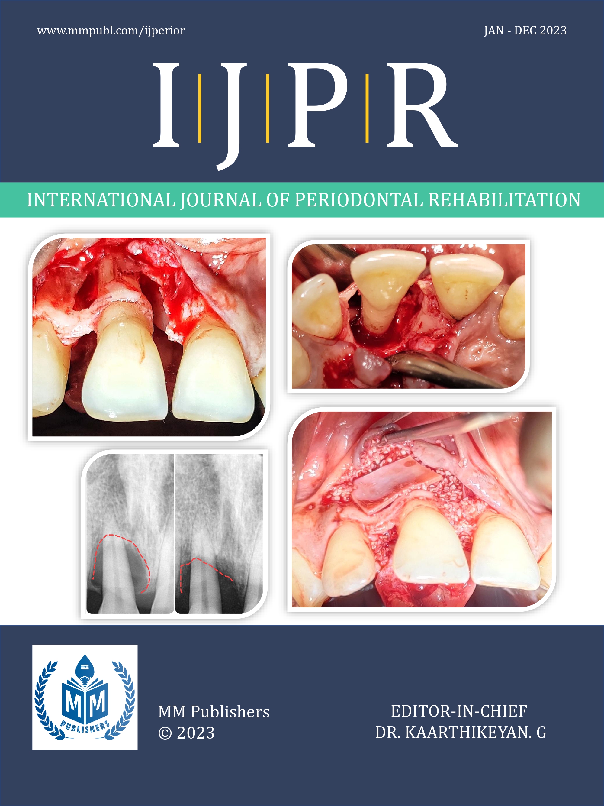 					View 2023:  International Journal of Periodontal Rehabilitation
				